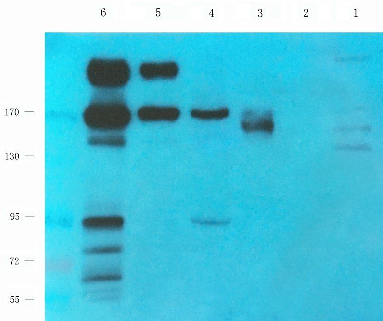 ROCK2 Rabbit Polyclonal Antibody