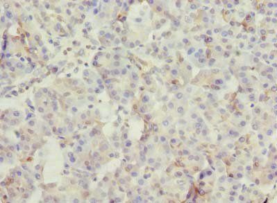 ROGDI Antibody