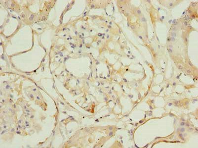 ROGDI Antibody