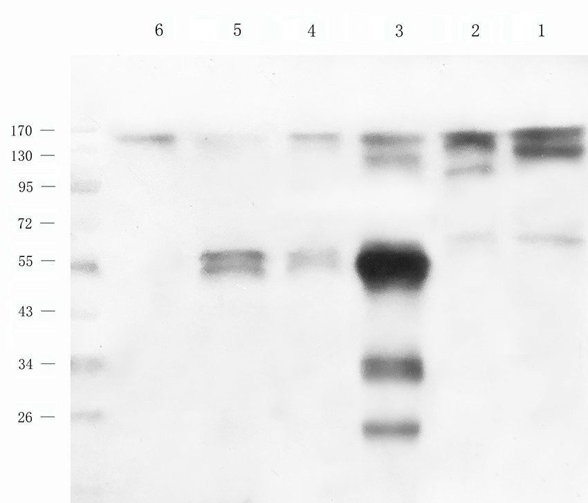 ROR gamma T Rabbit Polyclonal Antibody