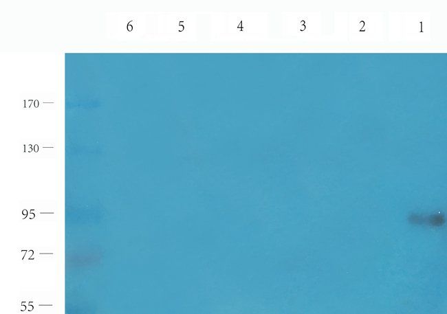 ROS1 Rabbit Polyclonal Antibody