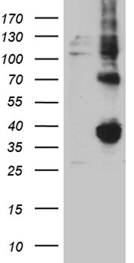 POLR2J Antibody