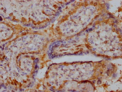 RPIA Antibody