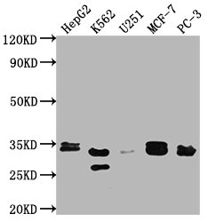 RPIA Antibody