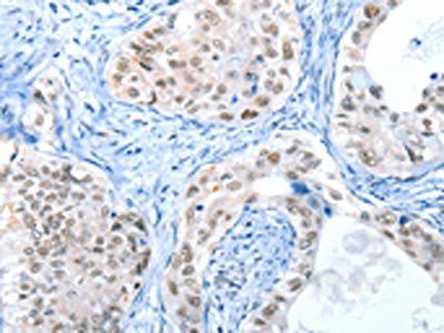 RPL15 Antibody