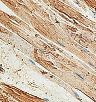 RPL27A Rabbit Polyclonal Antibody