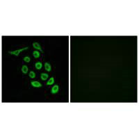 RPS12 Antibody