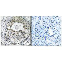 RPS13 Antibody