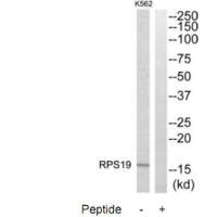 RPS19 Antibody