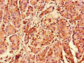 RPS26 Antibody