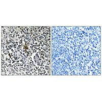 RPS3 Antibody