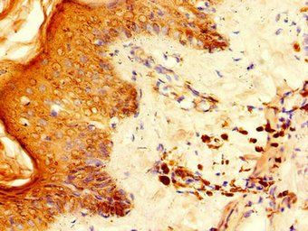 RPS6 Antibody