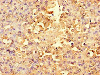 RPS6 Antibody