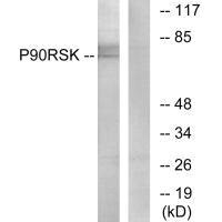 RPS6KA1 Antibody