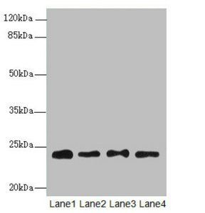 RPS8 Antibody