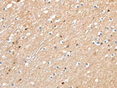 RRAD Antibody