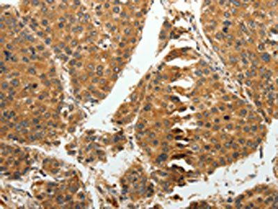 RRM1 Antibody
