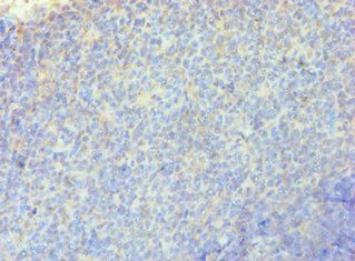 RRM2B Antibody
