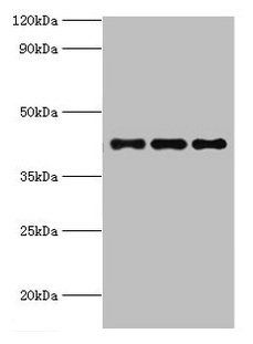 RRM2B Antibody