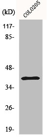RRM2B Antibody