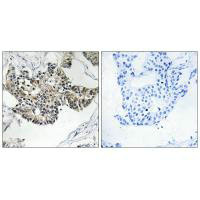 RSAD1 Antibody