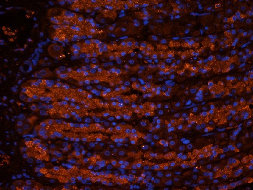 RSPO3 antibody