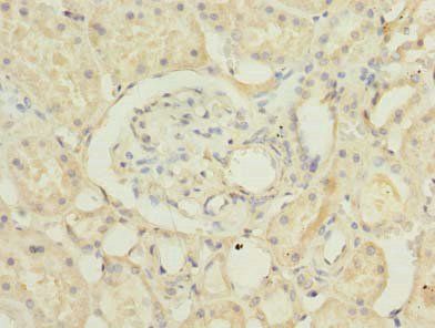 RUSC1 Antibody