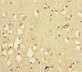 RYR2 Antibody