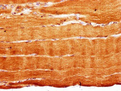 RYR3 Antibody