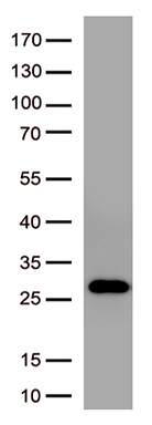 S Protein Rabbit Antibody