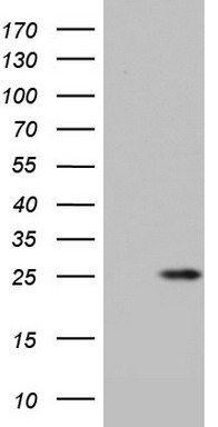 S100A6 Antibody