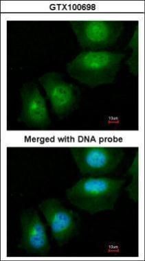 S100A11 Rabbit Polyclonal Antibody