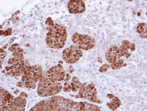 S100A11 Rabbit Polyclonal Antibody