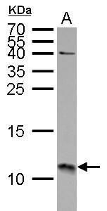 S100A11 Rabbit Polyclonal Antibody