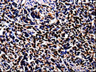 S100A4 Antibody