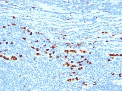 S100A8 Antibody