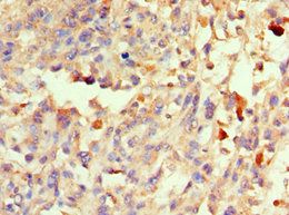 S100B Antibody
