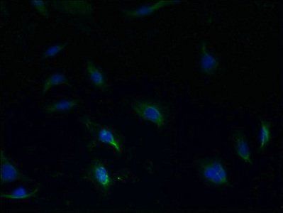 S1PR1 Antibody