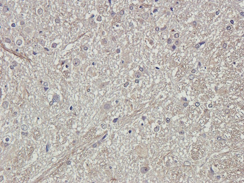 S1PR1 Rabbit Polyclonal Antibody