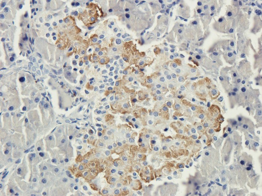 S1PR1 Rabbit Polyclonal Antibody