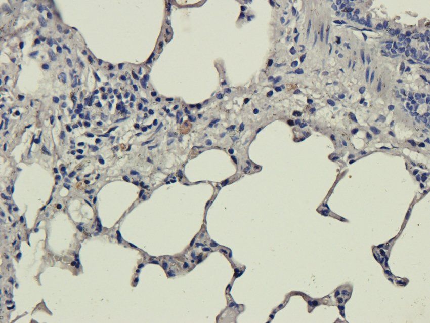 S1PR1 Rabbit Polyclonal Antibody