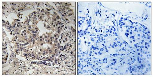 S6 Ribosomal Protein (Phospho-Ser235+Ser236) Antibody