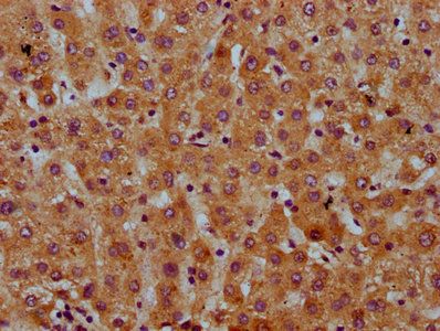 SAA2 Antibody