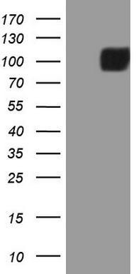 SAE1 Antibody
