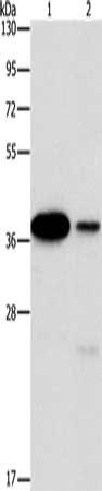 SAE1 Antibody