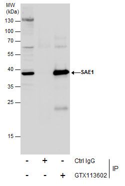 SAE1 antibody