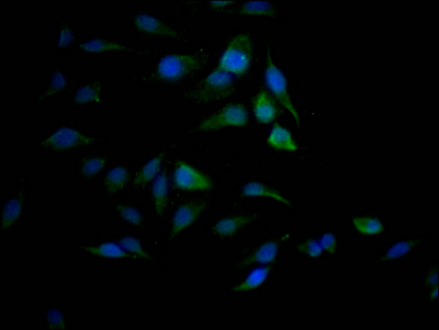 SAE1 Recombinant Monoclonal Antibody