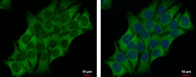 SAH3 Rabbit Polyclonal Antibody