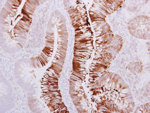 SAH3 Rabbit Polyclonal Antibody