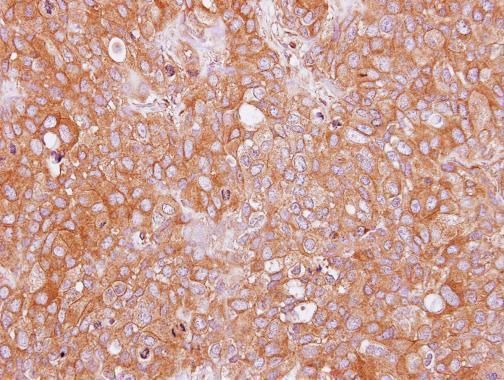 SAH3 Rabbit Polyclonal Antibody